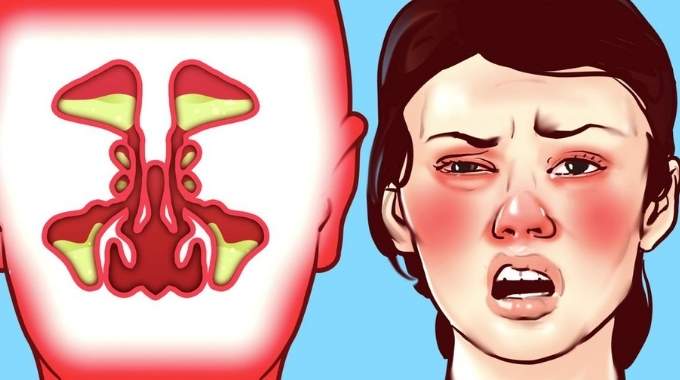 Comment déboucher son nez?