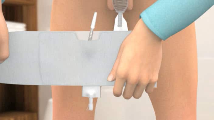 Comment placer et porter une poche à urine?