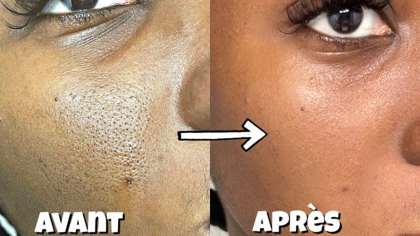 Comment resserrer les pores?