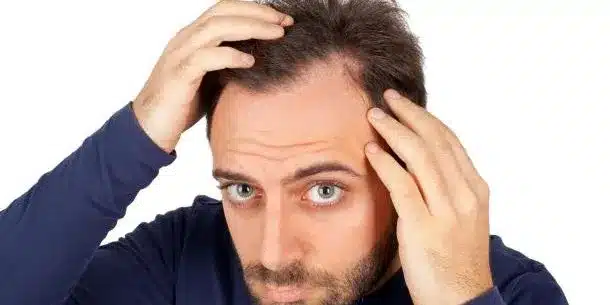 Début de calvitie : quelles sont les causes et comment la soigner ?